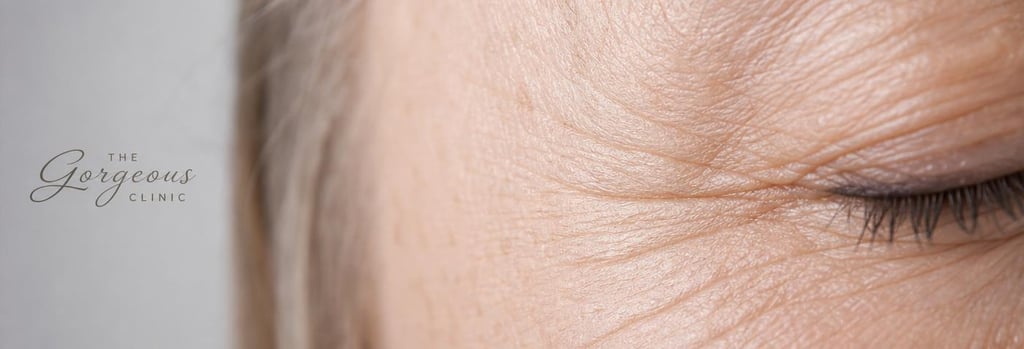 Photorealistic macro image of mature skin texture around the outer eye, close-up showing fine lines and gentle creasing, soft clinical lighting, neutral clinical surface in background, refined editorial feel, single focal point on skin texture, no faces, photorealistic detail.