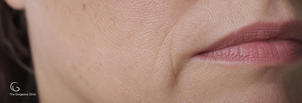 Photorealistic macro image of mature skin texture near the mouth, visible natural lines and pores, soft neutral clinical lighting, single focal point, editorial detail emphasizing mobility and texture.