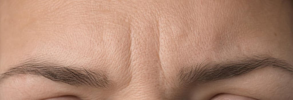 Photorealistic macro image of mature skin texture showing vertical glabellar lines between brows, editorial clinical lighting, shallow depth-of-field, negative space, realistic pores and fine lines, premium clinic aesthetic, no faces or branding.