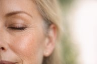 Crow's Feet Treatment | Anti-Wrinkle Injections Blackpool