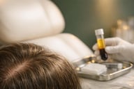 PRP Hair Restoration for Thinning Hair in Lancashire