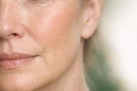 Dermal Filler Safety Guide | Safe Filler Treatment Blackpool