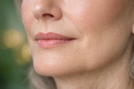 Can Lip Filler Trigger a Cold Sore? Prevention & Treatment