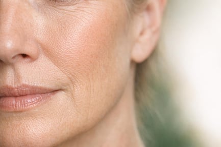 Dermal Filler Safety Guide | Safe Filler Treatment Blackpool