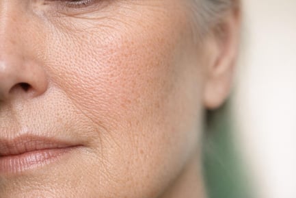 NHS Dermal Fillers Risks: Infection, Lumps and Safety Advice