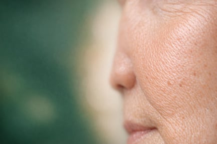 Collagen Banking – Preventative Treatments and Early Care UK