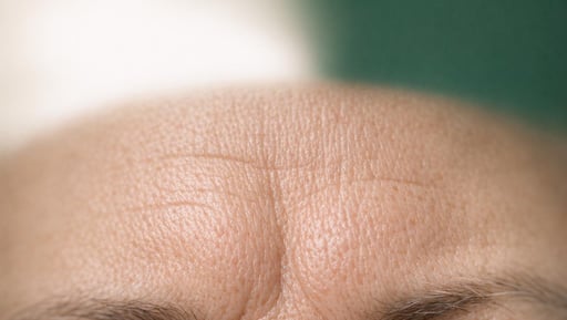 Frown Lines Treatment | Anti-Wrinkle Injections Blackpool