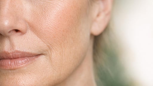 Dermal Filler Safety Guide | Safe Filler Treatment Blackpool