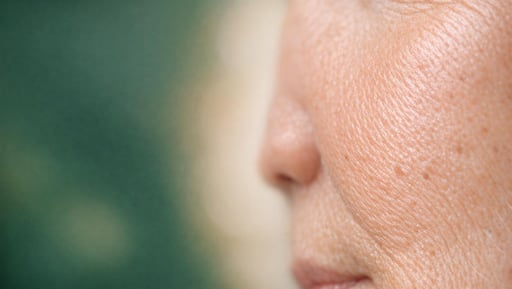 Collagen Banking – Preventative Treatments and Early Care UK